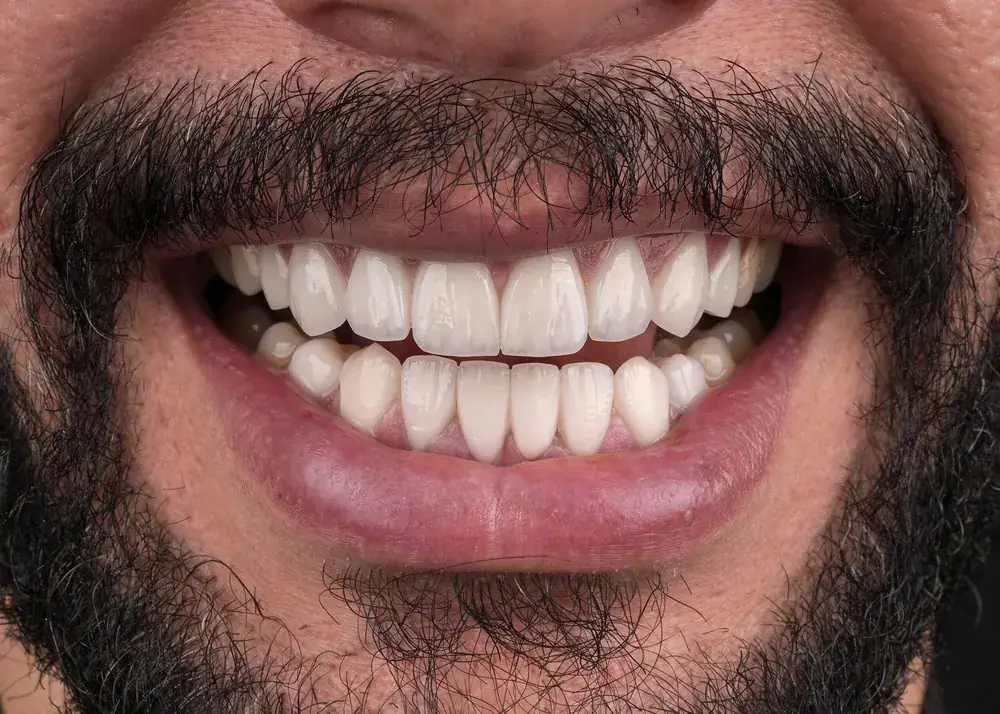 بعد