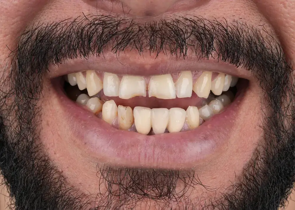قبل