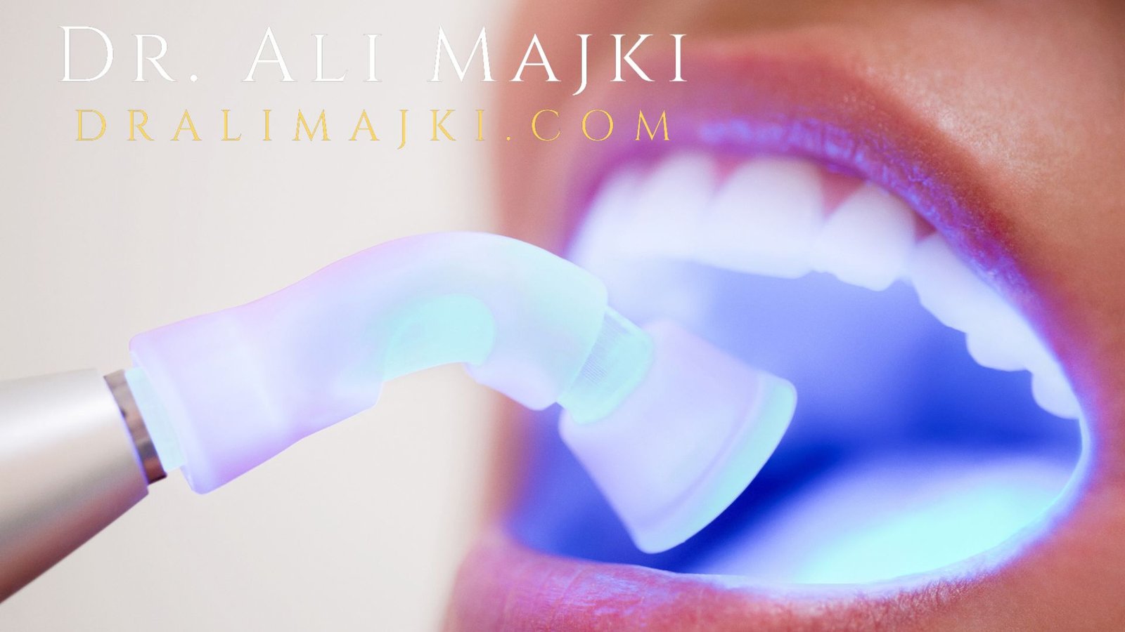 How Do We Manage the Aftermath of Maximally Invasive Cosmetic Dental Treatment Cosmetic Dentistry Clinic in Kuwait and Qatar