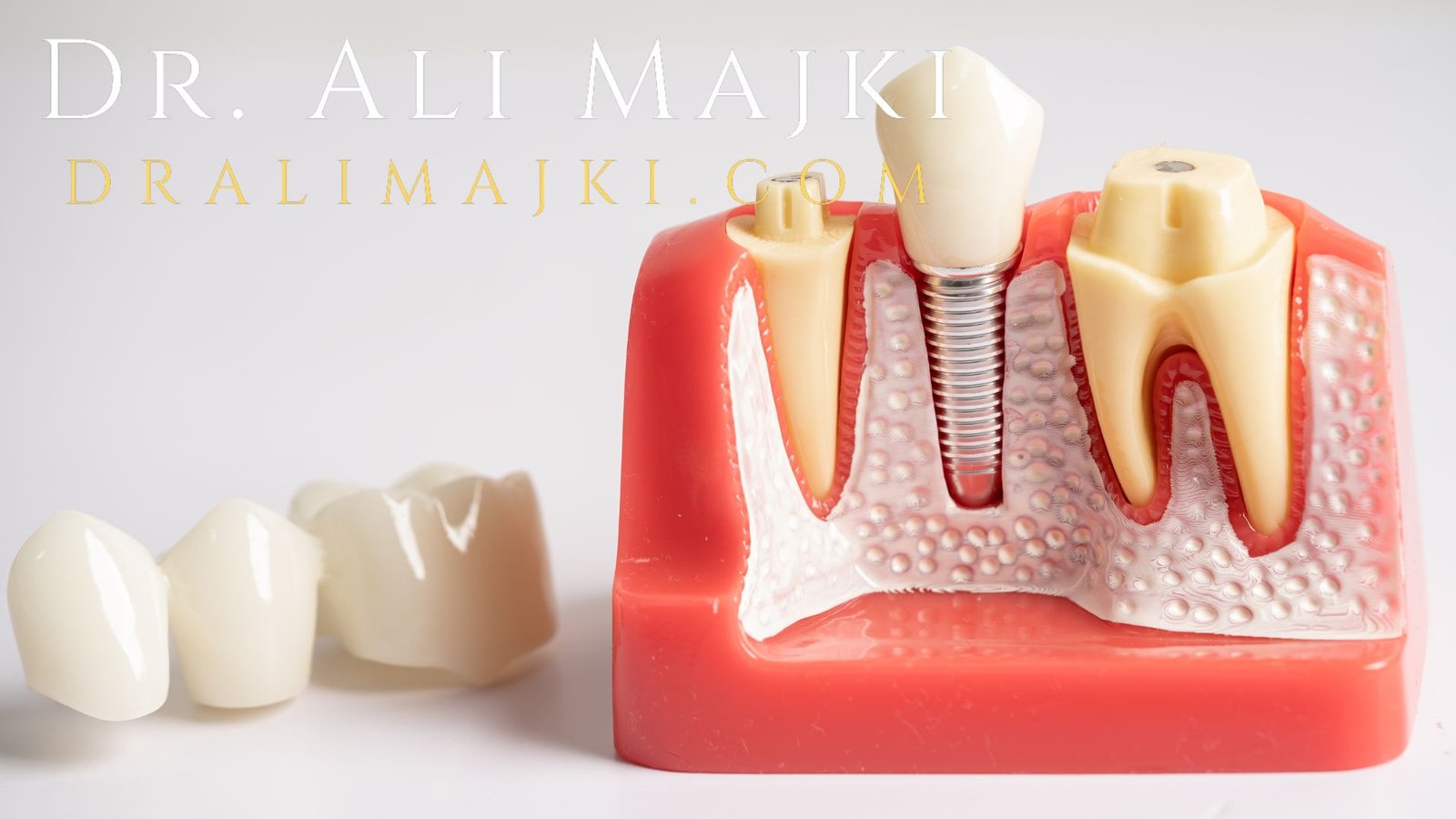 At Dr. Ali Majki’s cosmetic dentistry clinic in Kuwait, we believe that a beautiful smile should be accessible to everyone.