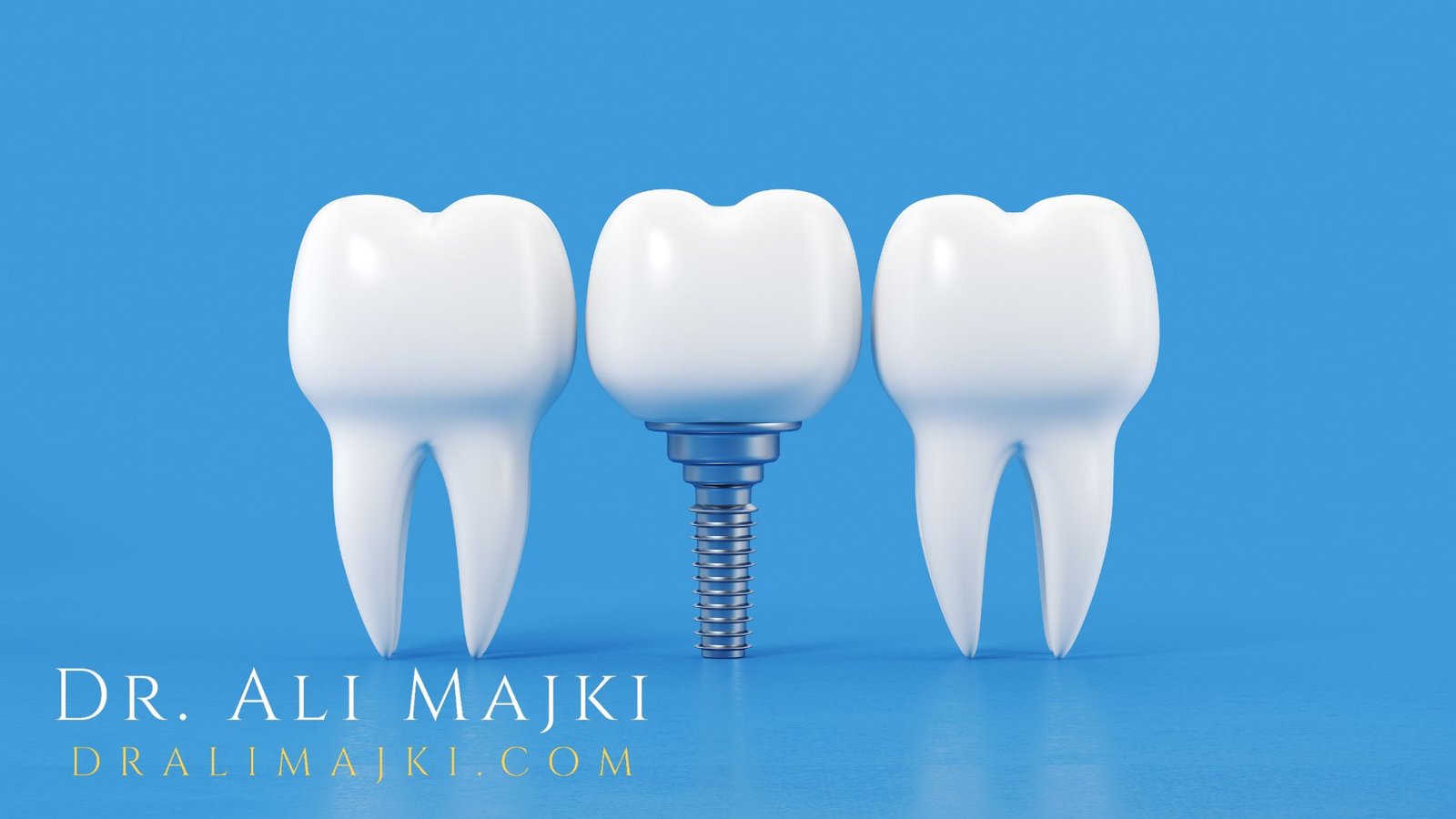 “Implants are designed to last a lifetime, but only if patients commit to proper hygiene,” adds Dr. Ali Majki, a leading expert in cosmetic dentistry who is also associated with Bayan Dental Clinic, Kuwait & Dao Medical Center, Qatar.