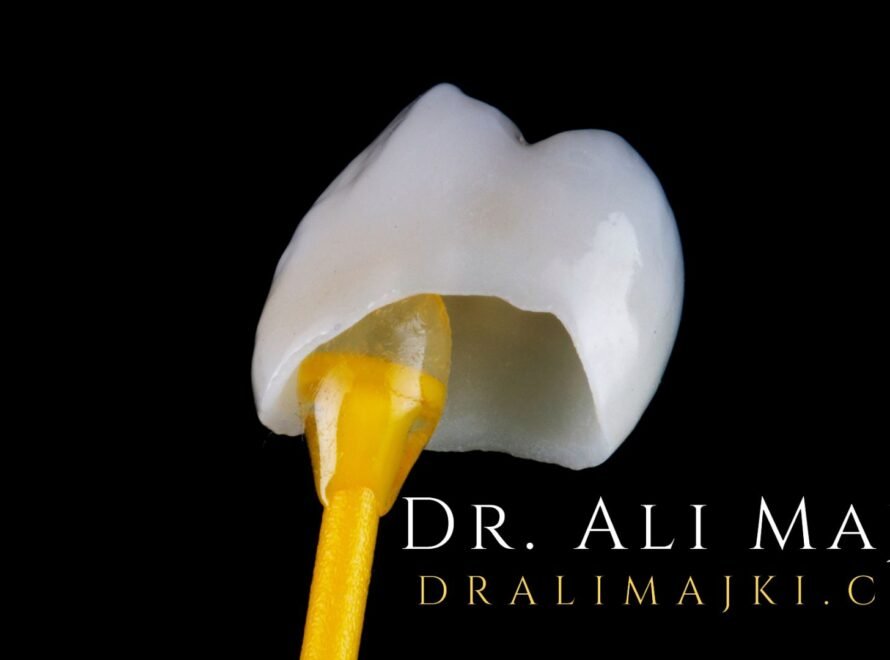 Dr. Ali Majki, a well-known Cosmetic Dentistry Consultant, who is also associated with Bayan Dental Clinic, Kuwait & Dao Medical Center, Qatar, plus, with extensive experience across the Middle East & Europe.