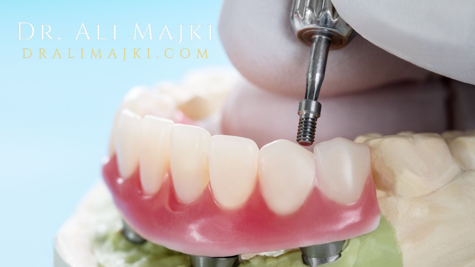 At Dr. Ali Majki’s premier cosmetic dentistry clinic in Kuwait, innovation meets excellence under the expert guidance of renowned cosmetic dentistry consultant - Dr. Ali Majki.