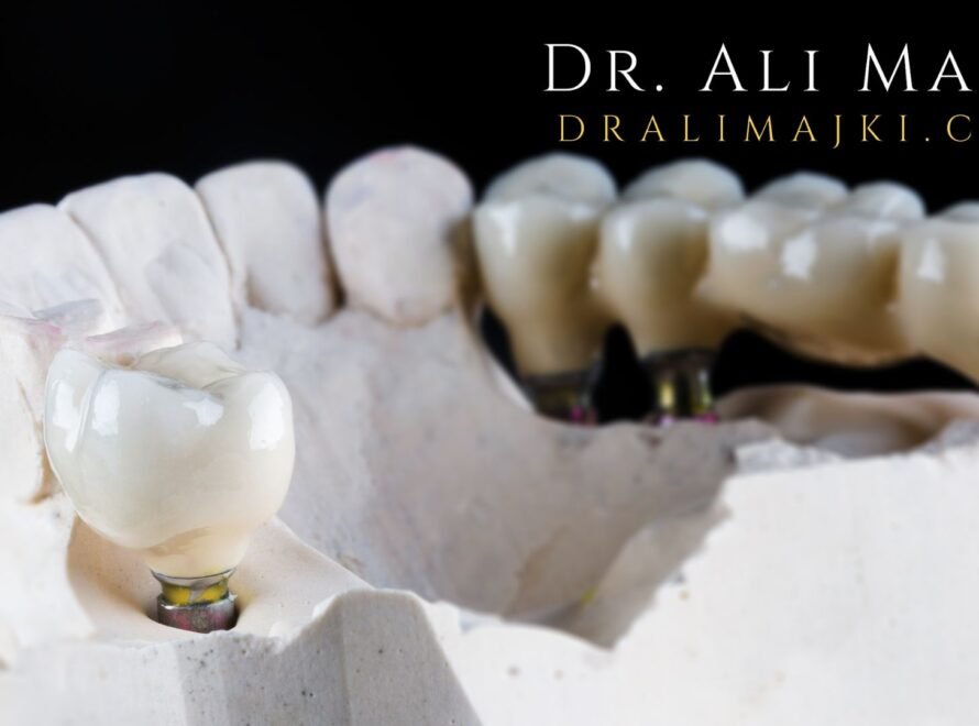 Why International Patients Choose Dr. Ali Majki in Kuwait. From the Gulf region to Europe, Far East & beyond, patients are traveling to Kuwait for Dr. Ali Majki’s advanced restorative procedures and VIP Medical Tourism experience.