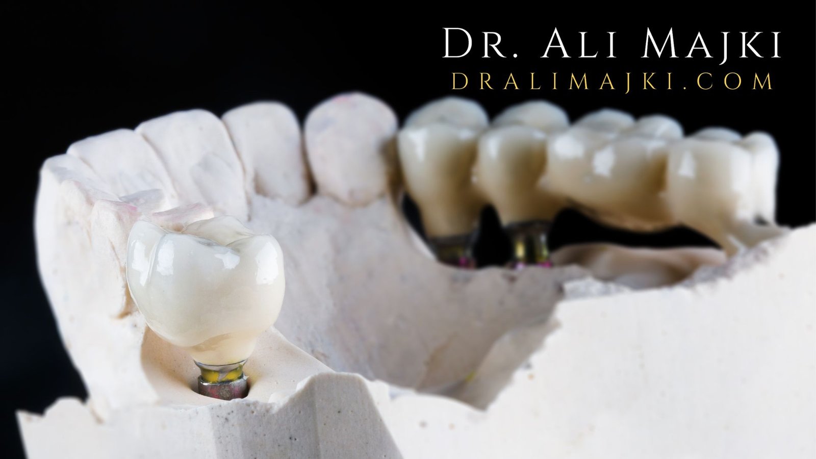 Why International Patients Choose Dr. Ali Majki in Kuwait. From the Gulf region to Europe, Far East & beyond, patients are traveling to Kuwait for Dr. Ali Majki’s advanced restorative procedures and VIP Medical Tourism experience.