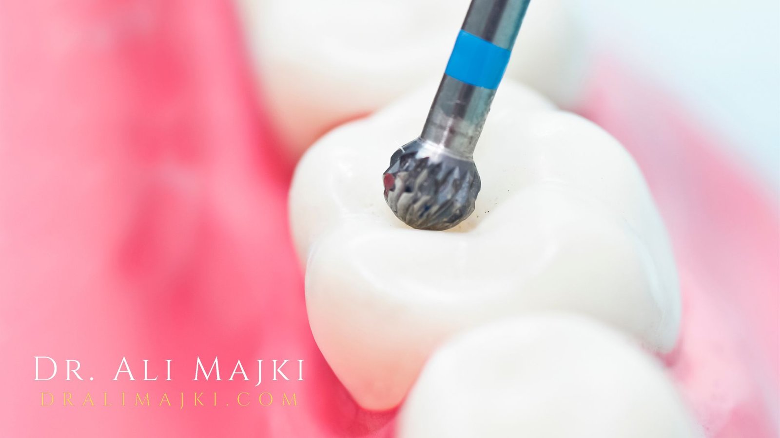 With VIP service, discreet appointments & concierge-level care, Dr. Ali Majki offers more than cosmetic dentistry, his cosmetic dentistry clinic offers youthful confidence, refined & redefined.