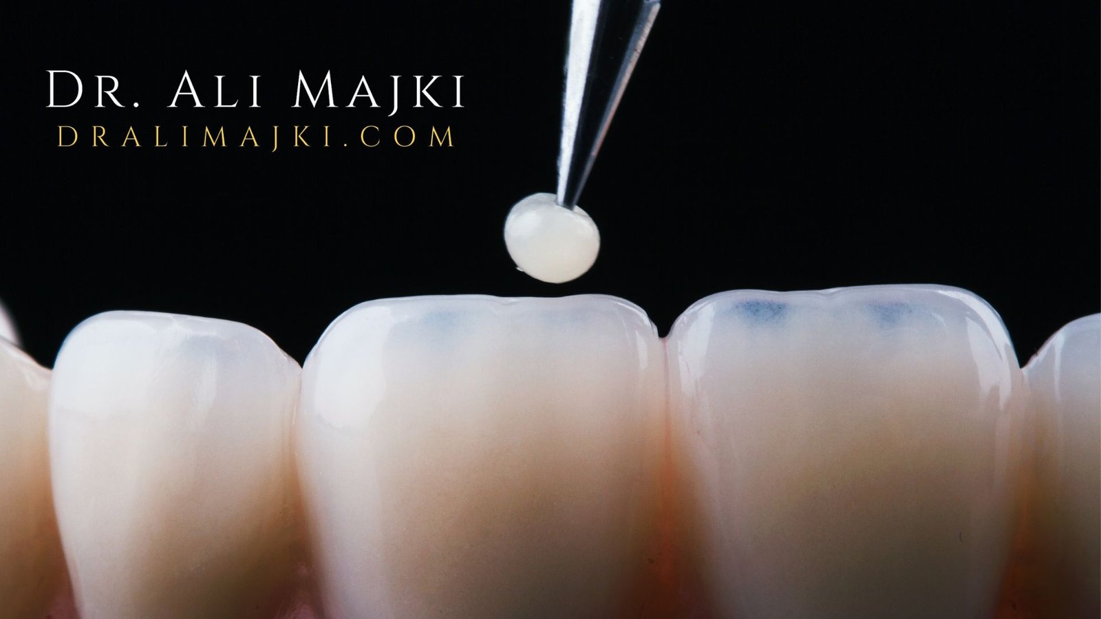 Dr. Ali Majki, Cosmetic Dentistry Consultant who is well-known for his aesthetic precision and patient-first approach, also associated with Bayan Dental Clinic, Kuwait & Dao Medical Center, Qatar, plus, with extensive experience across the GCC region.