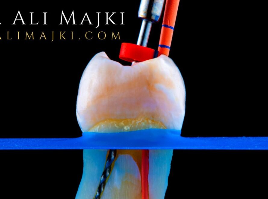 At his premier cosmetic dentistry clinic in Kuwait, Dr. Ali Majki has helped thousands of patients, from the GCC to Europe, Far East & North America to navigate their aesthetic options with clarity and confidence.