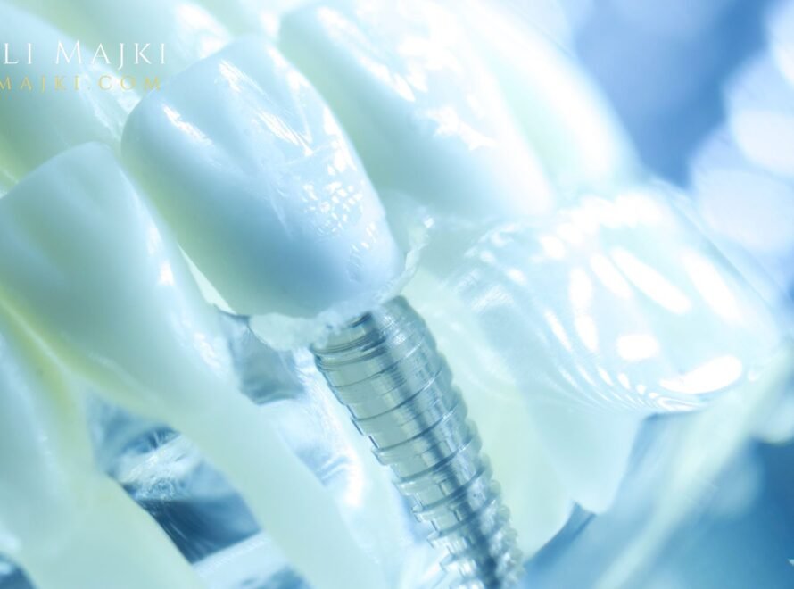 Dr. Ali Majki, who stands as a leading authority in cosmetic dentistry across the Middle East, pioneering a new standard of modern dental practice through the seamless fusion of advanced technology, precision and artistic excellence.