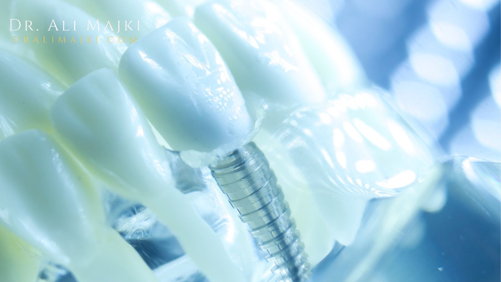 Dr. Ali Majki, who stands as a leading authority in cosmetic dentistry across the Middle East, pioneering a new standard of modern dental practice through the seamless fusion of advanced technology, precision and artistic excellence.